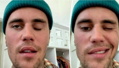 Justin Bieber le dio parálisis en la cara, mira todos los detalles.