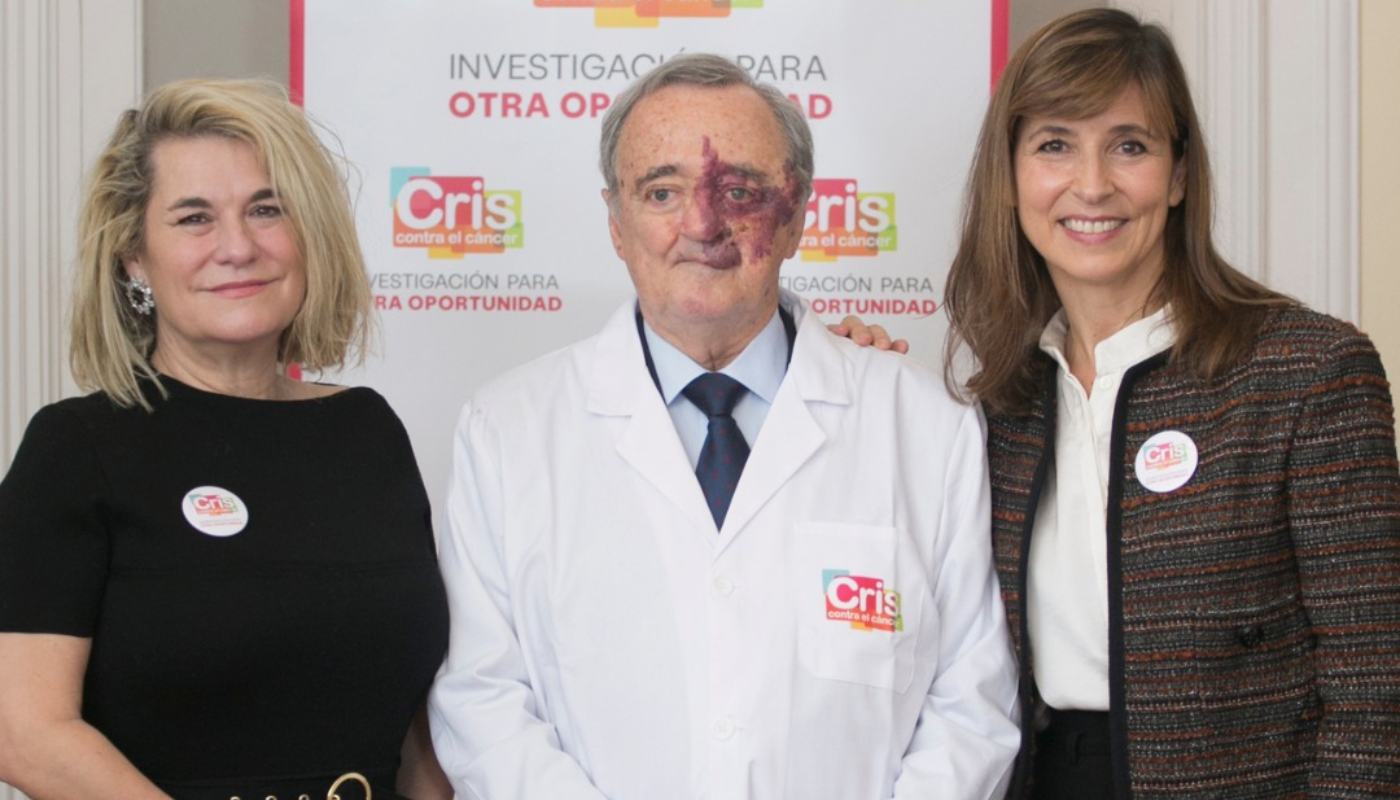 El cáncer de páncreas mostró una respuesta total al tratamiento. (Créditos: X)